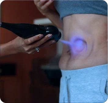 Cryolipolysis